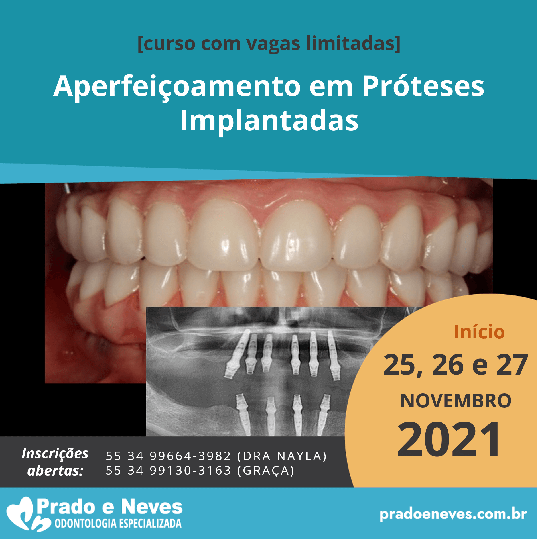 Aperfeiçoamento em próteses implantadas